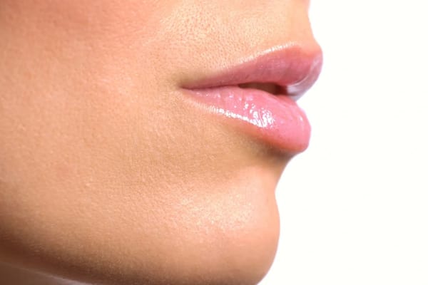 Lip, Cheek, Jaw & Face Dermal Filler